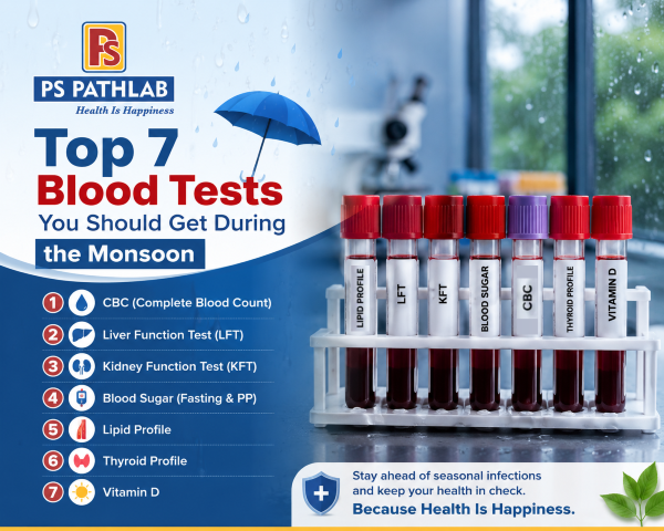 Top 7 Blood Tests You Should Get During the Monsoon