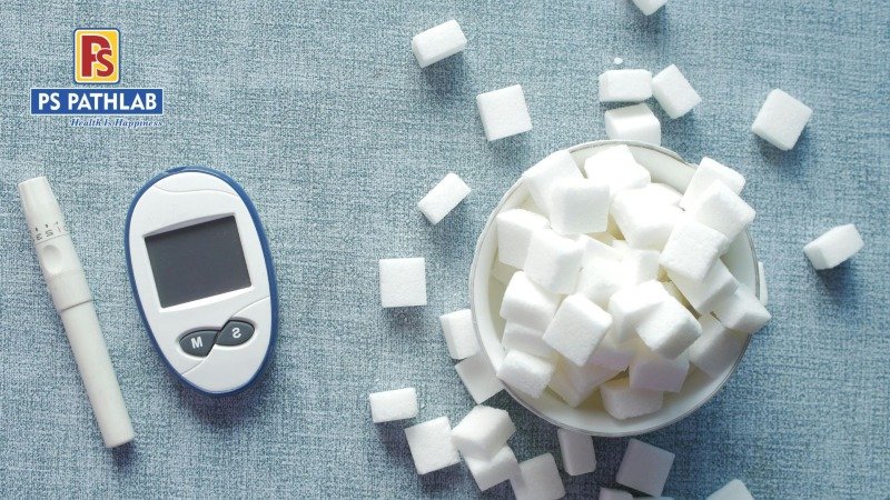 Diabetes Tests Explained: Complete Guide to Diabetes Blood Tests, HbA1c & Diabetes Screening