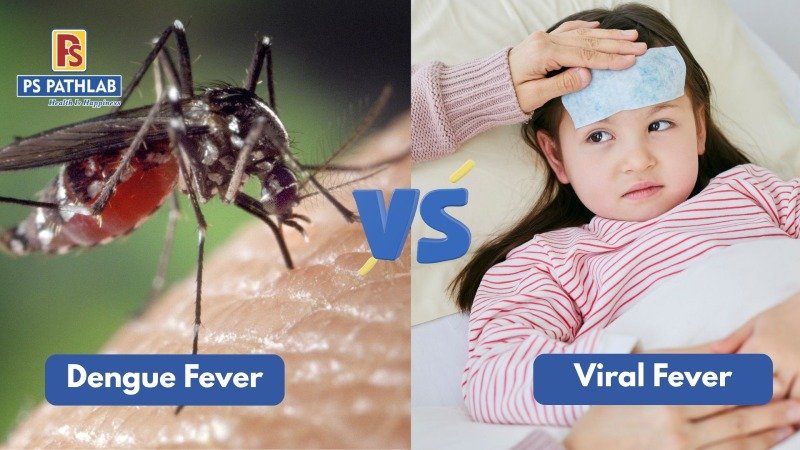 Dengue Symptoms vs Viral Fever: Blood Tests for Early Dengue Detection | PS Path Lab