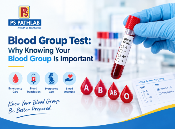 Blood Group Test: Why Knowing Your Blood Group Is Important