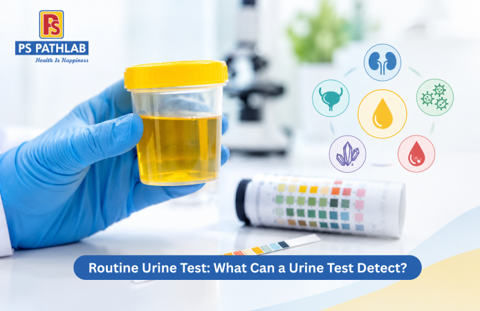 Routine Urine Test: What Can a Urine Test Detect?