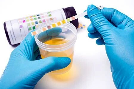 URINE  ROUTINE EXAMINATION